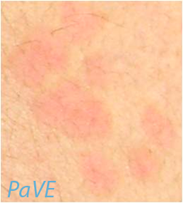 full image of PaVE HPV24 Gariglio 1 large.png